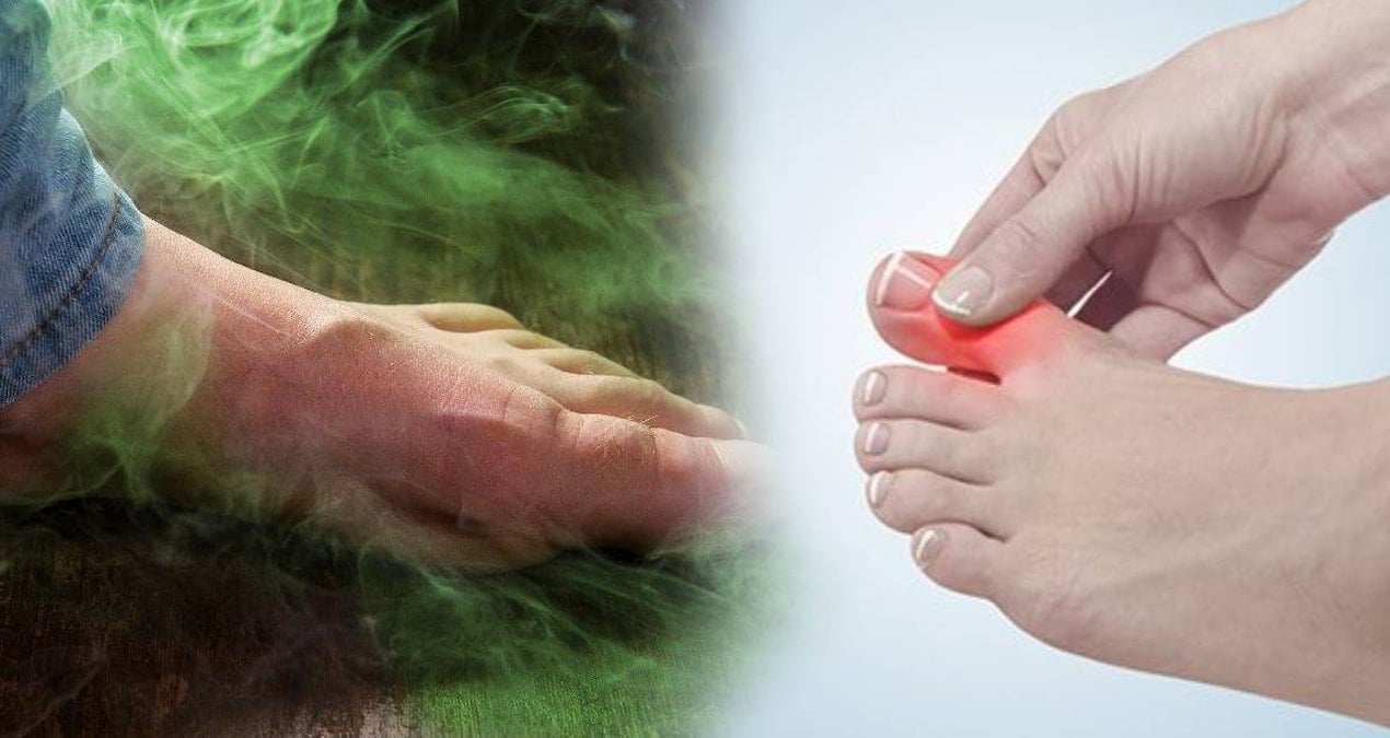 ayak mantarinin kokunu kurutuyor 2 malzeme yetiyor kokudan eser kalmiyor 3gkHJNYe