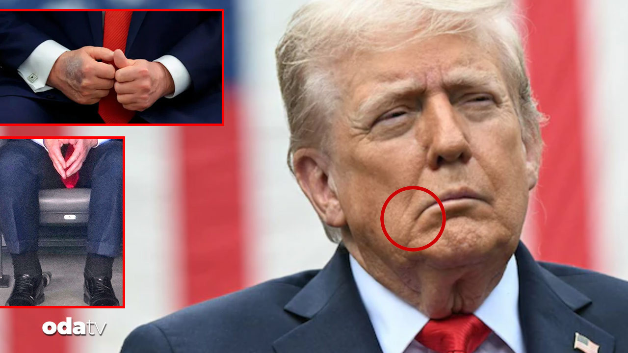 once elleri morardi sonra bilekleri sisti simdi de trumpin agzi yamuldu iancOU54