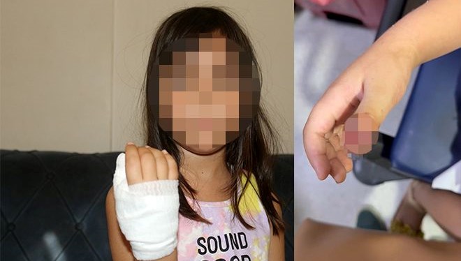anaokulunda korkunc olay dort yasindaki cocugun parmagi koptu c6u7g5t2