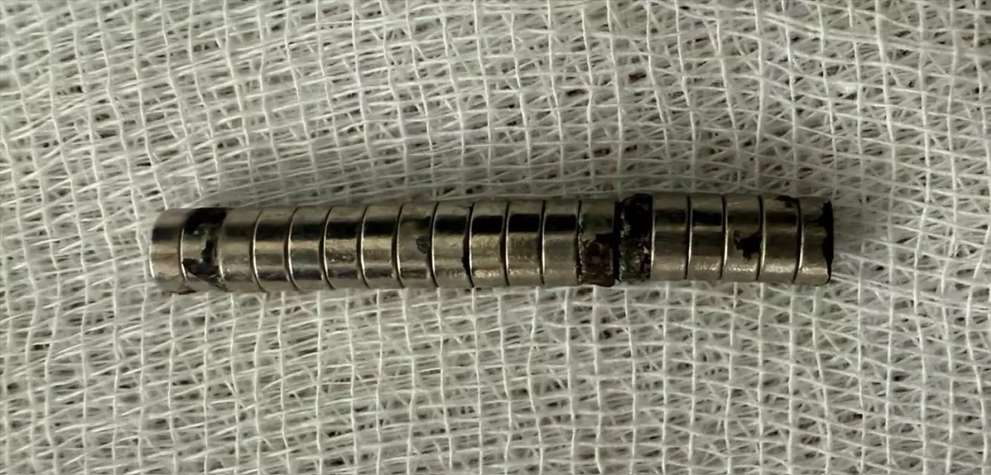 elazigda miknatis yutan cocuk kurtarildi v2wykvUn